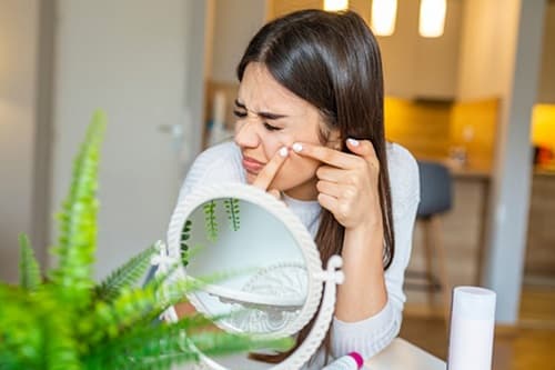 YAZ SONRASI SİVİLCELENME