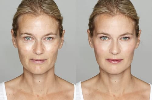 CİLT LEKELERİ MAKYAJLA NASIL KAPATILIR?