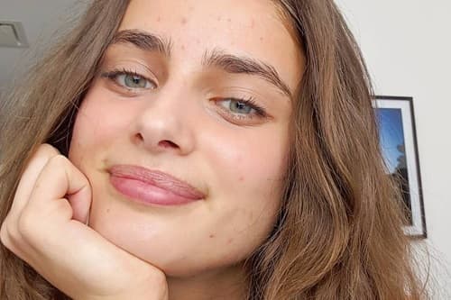 GÜNEŞ KREMİ NEDEN YÜZDE SİVİLCE YAPAR?